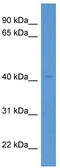 WD Repeat Domain 73 antibody, TA343028, Origene, Western Blot image 