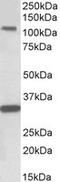 c-Kit antibody, TA320207, Origene, Western Blot image 