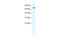 Nuclear Receptor Subfamily 4 Group A Member 1 antibody, 27-450, ProSci, Western Blot image 