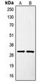 SURF1 Cytochrome C Oxidase Assembly Factor antibody, LS-C352891, Lifespan Biosciences, Western Blot image 