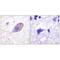 Potassium Voltage-Gated Channel Subfamily J Member 16 antibody, A10858, Boster Biological Technology, Immunohistochemistry paraffin image 