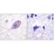 Inward rectifier potassium channel 16 antibody, A10858, Boster Biological Technology, Immunohistochemistry paraffin image 