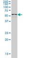 Zinc Finger Protein 136 antibody, H00007695-M03, Novus Biologicals, Western Blot image 