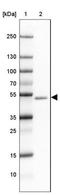 Gamma-Aminobutyric Acid Type A Receptor Alpha1 Subunit antibody, NBP2-33762, Novus Biologicals, Western Blot image 