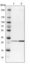 Solute Carrier Family 19 Member 2 antibody, PA5-53456, Invitrogen Antibodies, Western Blot image 