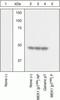 Mitogen-Activated Protein Kinase Kinase 1 antibody, GTX25615, GeneTex, Western Blot image 