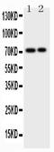 Endoglin antibody, PB9054, Boster Biological Technology, Western Blot image 