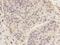 KIAA0100 antibody, NBP2-66915, Novus Biologicals, Immunohistochemistry paraffin image 