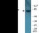 Microtubule Associated Protein Tau antibody, EKC2529, Boster Biological Technology, Western Blot image 