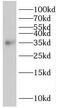 Sirtuin 4 antibody, FNab07882, FineTest, Western Blot image 