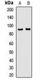 Adenosine Monophosphate Deaminase 1 antibody, orb412664, Biorbyt, Western Blot image 