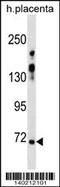 Zinc Finger Protein 251 antibody, 60-465, ProSci, Western Blot image 