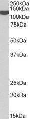 ADAM Metallopeptidase Domain 19 antibody, LS-B10602, Lifespan Biosciences, Western Blot image 