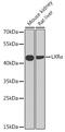 Nuclear Receptor Subfamily 1 Group H Member 3 antibody, GTX54542, GeneTex, Western Blot image 