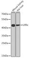 Nuclear Receptor Subfamily 1 Group H Member 3 antibody, GTX54542, GeneTex, Western Blot image 