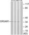 Olfactory Receptor Family 5 Subfamily AR Member 1 (Gene/Pseudogene) antibody, GTX87625, GeneTex, Western Blot image 