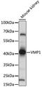 Vacuole Membrane Protein 1 antibody, LS-C750493, Lifespan Biosciences, Western Blot image 