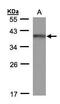 High Mobility Group 20B antibody, PA5-27996, Invitrogen Antibodies, Western Blot image 