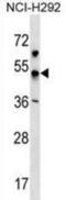 Potassium Voltage-Gated Channel Subfamily J Member 18 antibody, abx030642, Abbexa, Western Blot image 