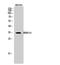 High Mobility Group 20B antibody, A08646-2, Boster Biological Technology, Western Blot image 