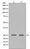 High Mobility Group Box 1 antibody, M00066-1, Boster Biological Technology, Western Blot image 