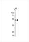Forkhead Box N4 antibody, 57-076, ProSci, Western Blot image 
