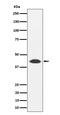 Nudix Hydrolase 19 antibody, M14864, Boster Biological Technology, Western Blot image 