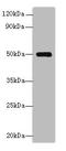 Serpin Family H Member 1 antibody, A60854-100, Epigentek, Western Blot image 