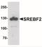 Sterol Regulatory Element Binding Transcription Factor 2 antibody, NBP2-41282, Novus Biologicals, Western Blot image 