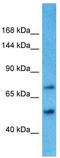 TBC1 Domain Family Member 8B antibody, TA331514, Origene, Western Blot image 