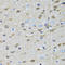 Golgi Membrane Protein 1 antibody, LS-C346328, Lifespan Biosciences, Immunohistochemistry frozen image 