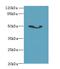 Adenosine Deaminase Like antibody, LS-C394501, Lifespan Biosciences, Western Blot image 