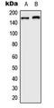 AT-Rich Interaction Domain 1B antibody, LS-C354185, Lifespan Biosciences, Western Blot image 