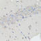 Chromogranin A antibody, LS-C746787, Lifespan Biosciences, Immunohistochemistry paraffin image 