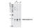 TNF Receptor Superfamily Member 12A antibody, 4403S, Cell Signaling Technology, Western Blot image 