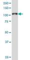 Protein Tyrosine Kinase 2 Beta antibody, H00002185-M01, Novus Biologicals, Western Blot image 