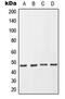 Neutrophil Cytosolic Factor 1 antibody, MBS821961, MyBioSource, Western Blot image 