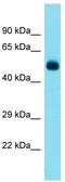 Q5I2P1 antibody, TA342293, Origene, Western Blot image 