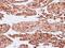 Keratin 7 antibody, GTX109723, GeneTex, Immunohistochemistry paraffin image 