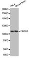 Phosphatidylinositol-4,5-Bisphosphate 3-Kinase Catalytic Subunit Alpha antibody, LS-C332098, Lifespan Biosciences, Western Blot image 