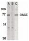 Beta-Secretase 1 antibody, PA5-19952, Invitrogen Antibodies, Western Blot image 