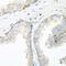 NEDD4 E3 Ubiquitin Protein Ligase antibody, GTX32745, GeneTex, Immunohistochemistry paraffin image 