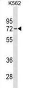 Interleukin 22 Receptor Subunit Alpha 1 antibody, abx030783, Abbexa, Western Blot image 