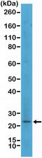 MART1 antibody, MA5-27949, Invitrogen Antibodies, Western Blot image 