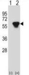 Protein Kinase CAMP-Dependent Type II Regulatory Subunit Beta antibody, abx028447, Abbexa, Western Blot image 