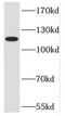 DNA Methyltransferase 3 Alpha antibody, FNab02485, FineTest, Western Blot image 
