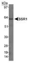 Somatostatin Receptor 1 antibody, NB300-120, Novus Biologicals, Western Blot image 