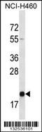 Transmembrane P24 Trafficking Protein 2 antibody, 56-877, ProSci, Western Blot image 