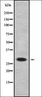 Claudin 18 antibody, orb338188, Biorbyt, Western Blot image 