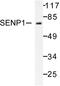 Sentrin-specific protease 1 antibody, LS-C176345, Lifespan Biosciences, Western Blot image 